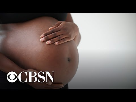 Study: Miscarriage rates 43% higher in Black women