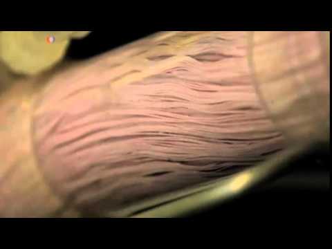 New Treatment for Deadly Septic Shock Could Save Millions