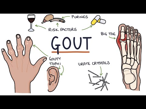 Gout: Visual Explanation for Students