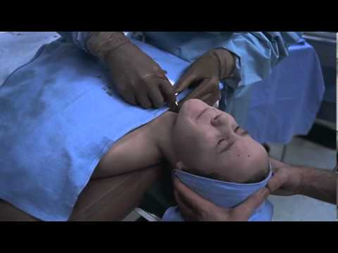Exorcist MED1