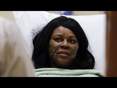 Fingernails Grow on Woman&#039;s Head
