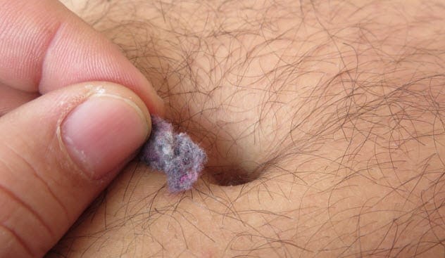Navel fluff
