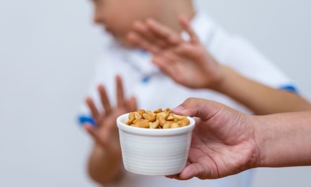 peanut allergy