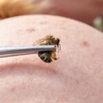 10 Medical Treatments Doctors Might Not Approve Of