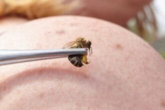 10 Medical Treatments Doctors Might Not Approve Of