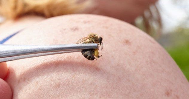 10 Medical Treatments Doctors Might Not Approve Of