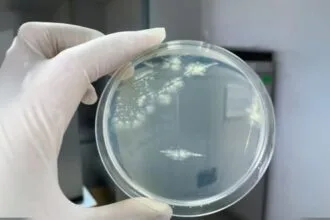 Microbial Art: 10 Cool Facts About Bacteria Paintings