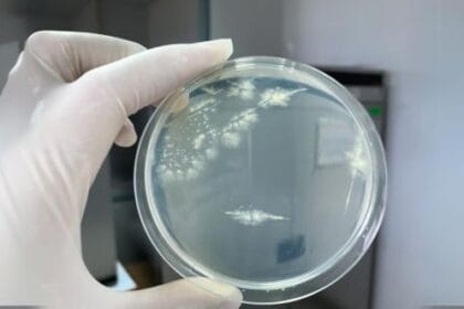 Microbial Art: 10 Cool Facts About Bacteria Paintings