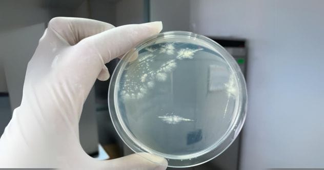 Microbial Art: 10 Cool Facts About Bacteria Paintings