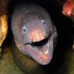 10 Wildest 'I Fell On It' ER Stories: You Won't Believe #1!