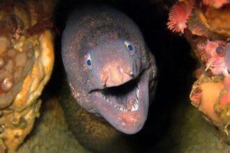 10 Wildest 'I Fell On It' ER Stories: You Won't Believe #1!