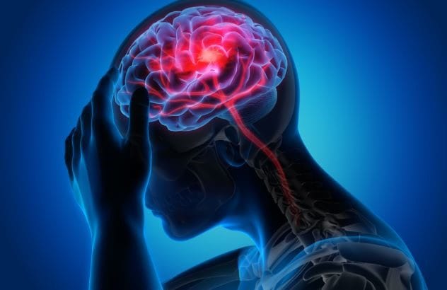 Brain scan representing neurodegenerative disease research