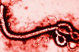 10 Reasons Ebola Isn't the Apocalypse You Fear