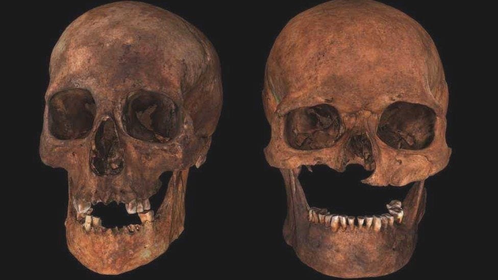 Skulls