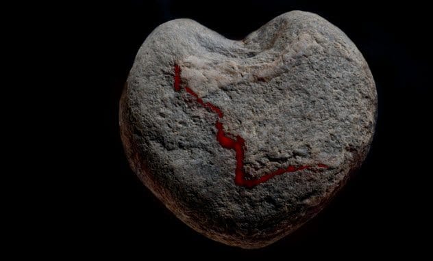 kidney stone surgery