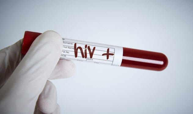 HIV/AIDS Treatment