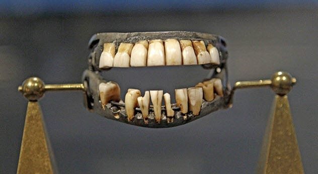 Dentures found as evidence in an acid bath murder case