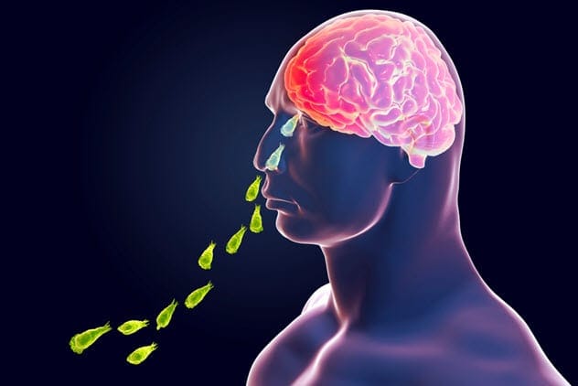 Brain-Eating Amoeba
