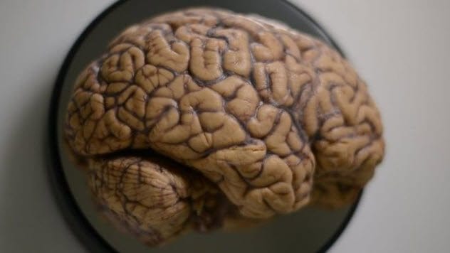 human brain
