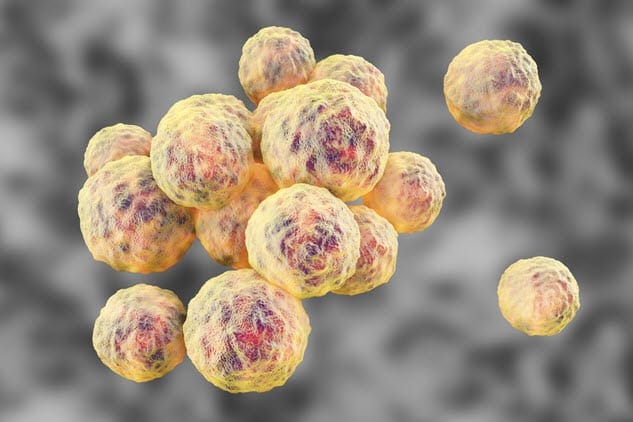 MRSA