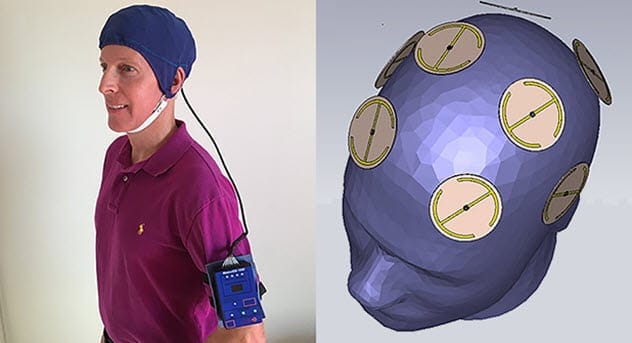 The MemorEM Head Device