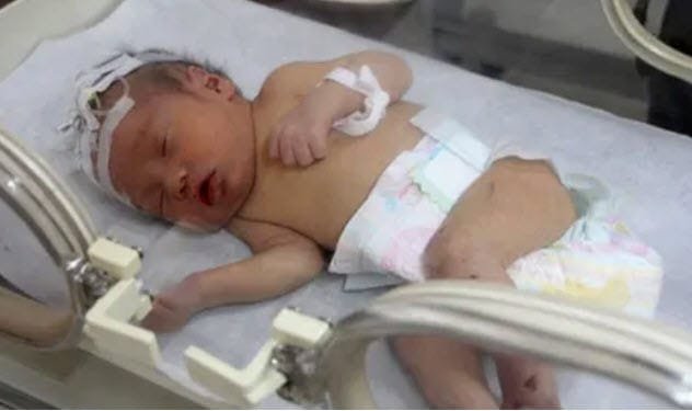 premature baby