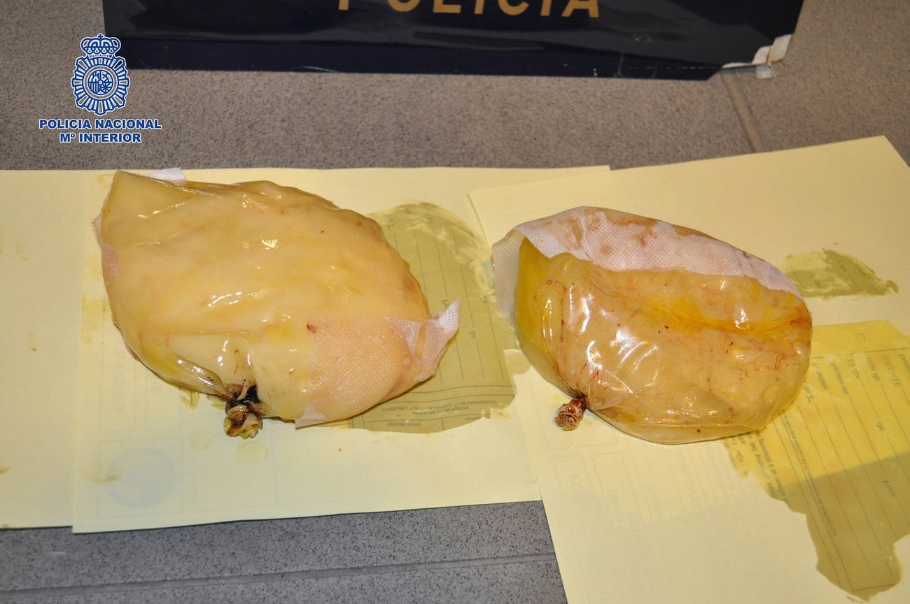 Image of a woman's breast