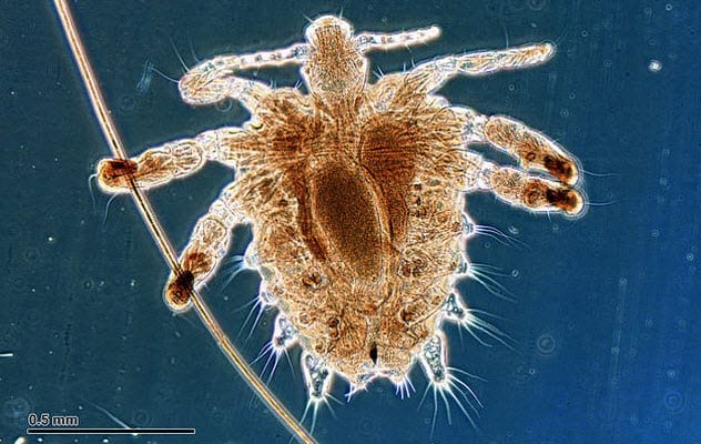 Crab Louse