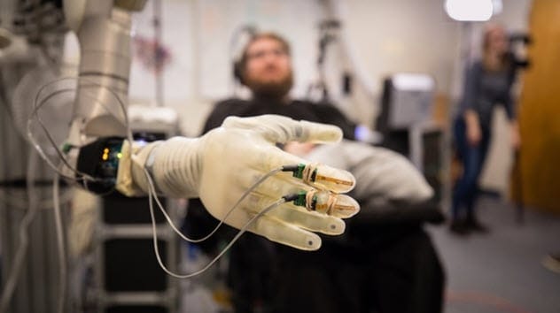 Mind-controlled prosthetic arm