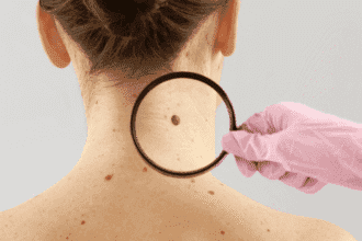 Gross Body Surprises: Top 10 Weird Things on Your Body