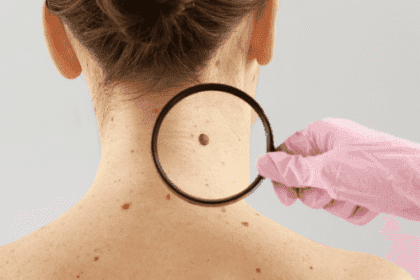 Gross Body Surprises: Top 10 Weird Things on Your Body