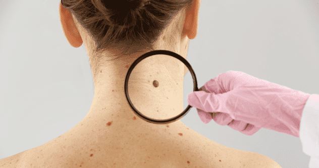 Gross Body Surprises: Top 10 Weird Things on Your Body