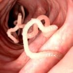 10 Surprising Disease Cures That Sound Like Science Fiction