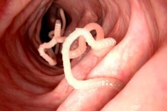 10 Surprising Disease Cures That Sound Like Science Fiction