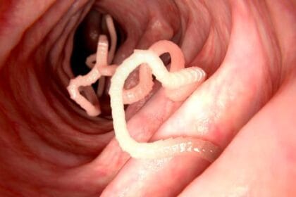 10 Surprising Disease Cures That Sound Like Science Fiction