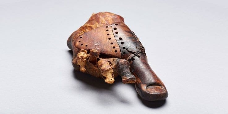 Oldest Prosthetic Device