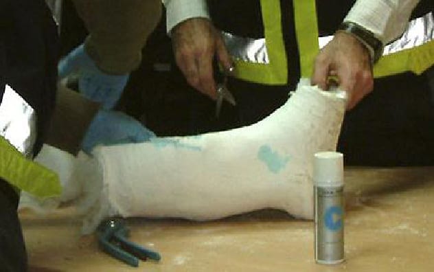 Image of a cocaine cast