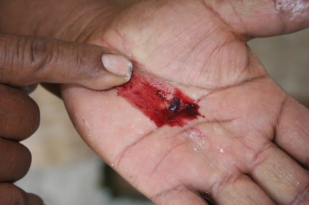 Cochineal insects on a cactus, the source of carmine red dye