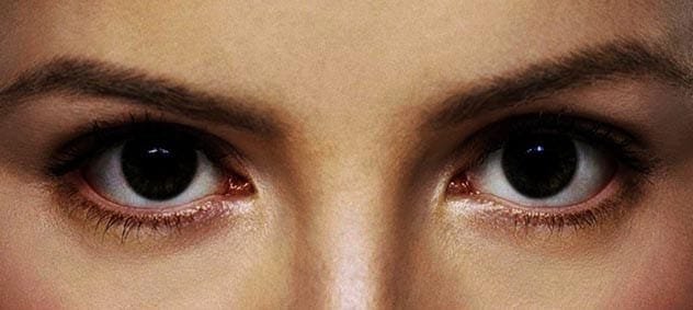 Scopophobia