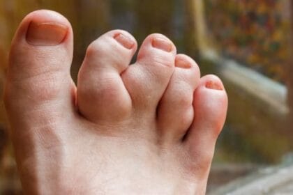 Celeb Deformities: 10 Stars & Their Unique Traits