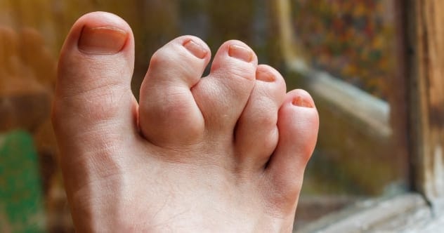 Celeb Deformities: 10 Stars & Their Unique Traits