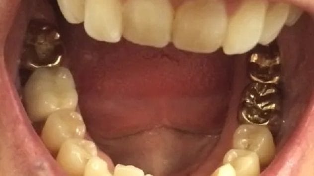 Illustration of a boy with a golden tooth