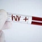 10 HIV Breakthroughs: Inspiring Stories of Hope & Progress