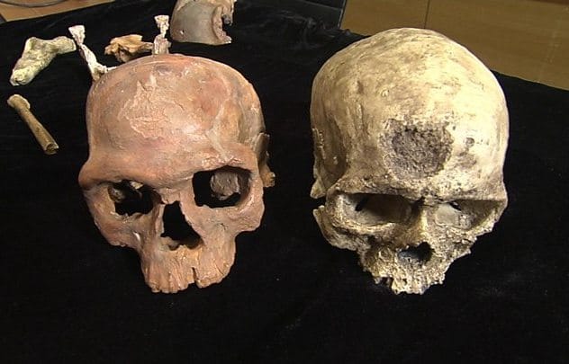 Human skulls used for medicine