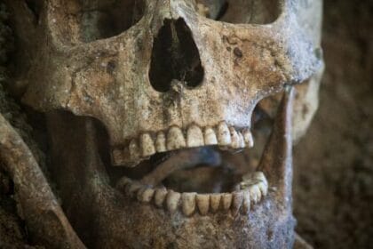 10 Times Teeth Solved Crimes: Amazing Forensic Dentistry Cases