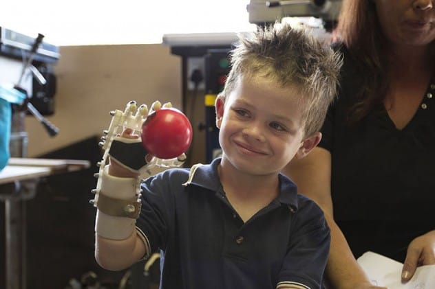 Bionic Prosthetics