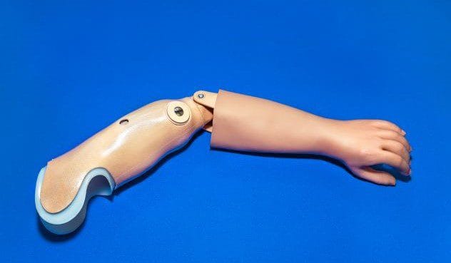 Concept image of a prosthetic arm and a car crash