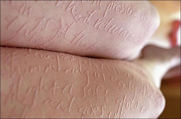Close-up of skin, illustrating the miracle baby story with text
