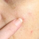 Gross Facts: 10 Things You Didn't Know About Your Skin