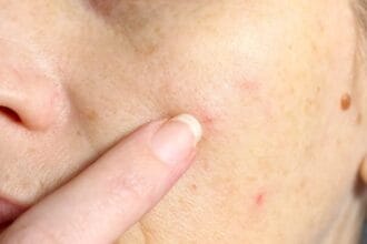 Gross Facts: 10 Things You Didn't Know About Your Skin